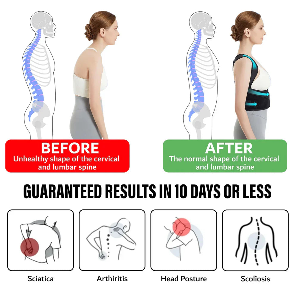 UpRight™ back Posture Corrector