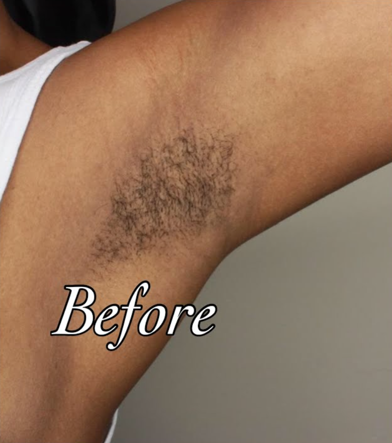 No-shave Body Hair Removal Cream Capture_d_ecran_2025-09-24_145126