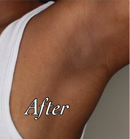 No-shave Body Hair Removal Cream