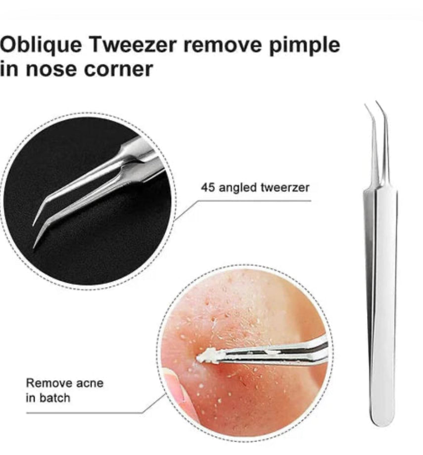 Professional Facial Blackhead Remover Tweezers (3Pcs+Box)