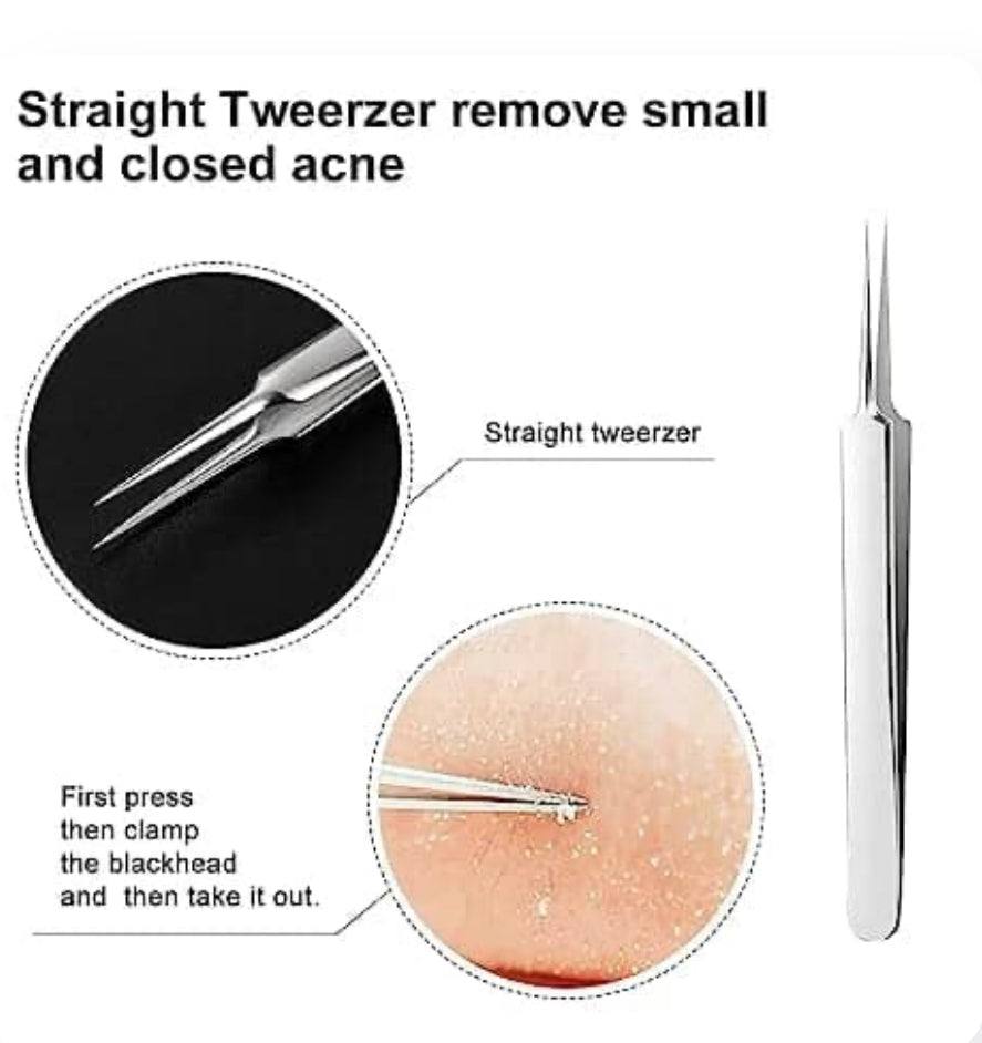 Professional Facial Blackhead Remover Tweezers (3Pcs+Box)