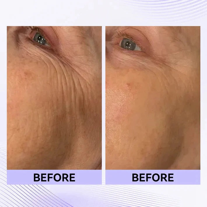 Instant Eye Tightener Easy-Wear Technology