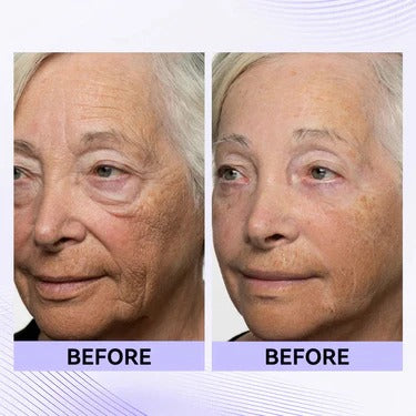 Instant Eye Tightener Easy-Wear Technology